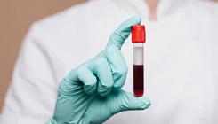 Биохимический анализ крови: правила сдачи