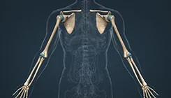 КТ костей верхних конечностей (предплечья или плеча)