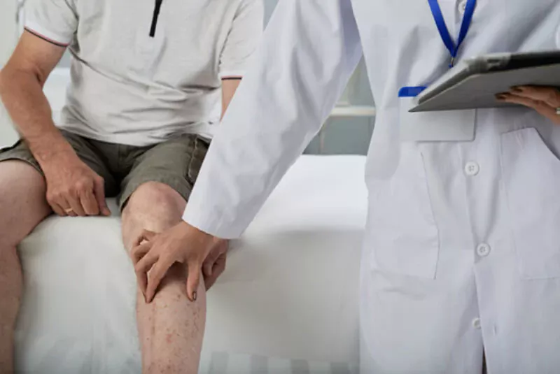 Степени артроза коленного сустава (гонартроза). Фото