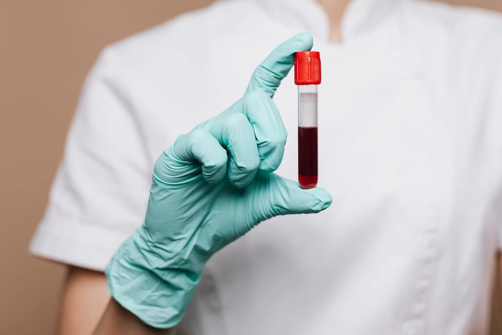Биохимический анализ крови: правила сдачи. Фото